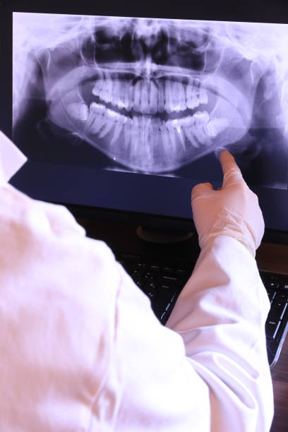 Best Emergency Tooth Extraction  in Bethany, OR